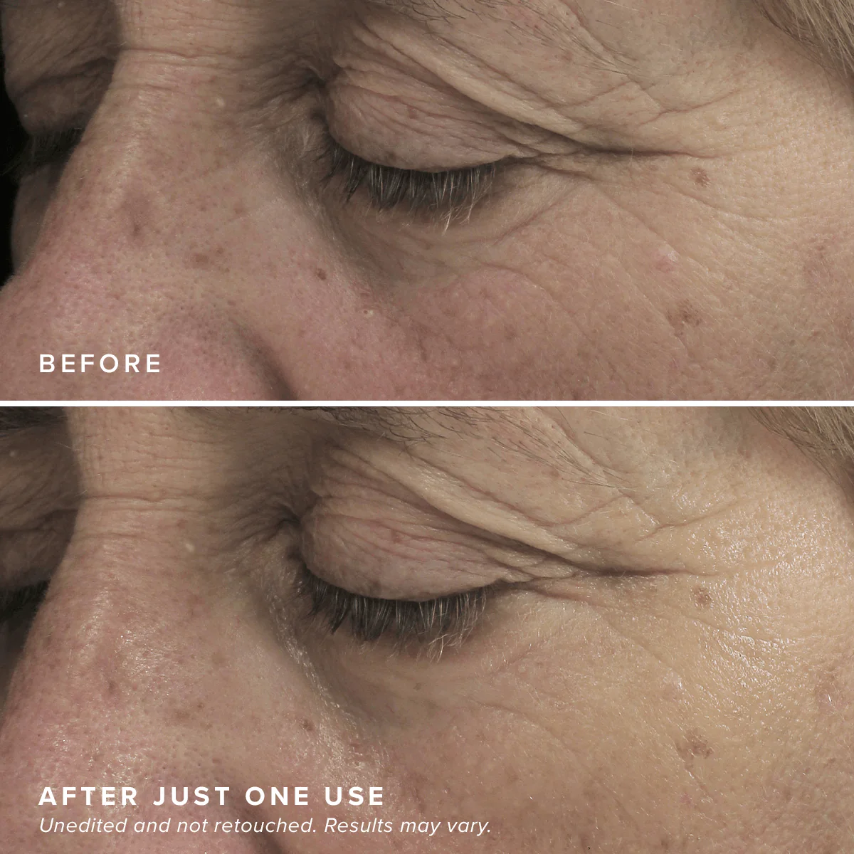 Brightening Eye Masks - Image 6