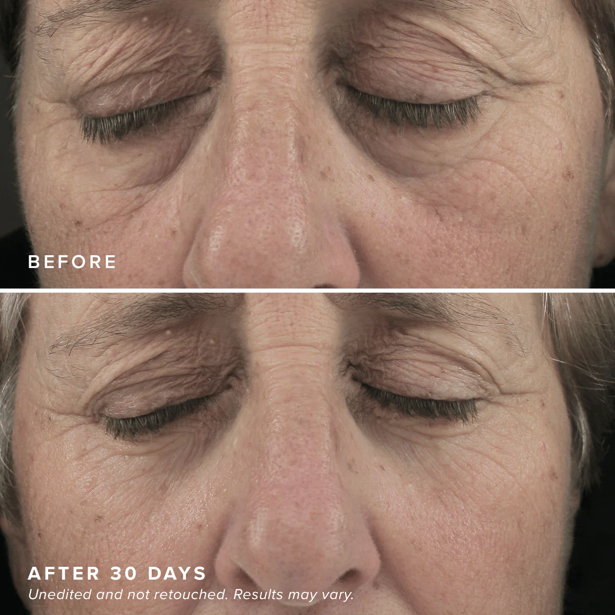 Brightening Eye Masks - Image 7